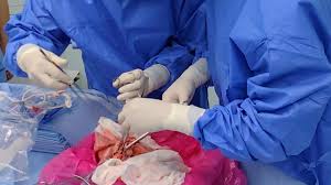 Doctors perform first successful pig lung transplant in human body