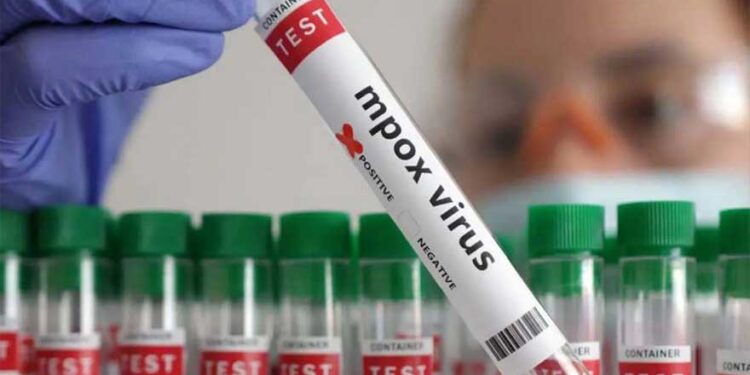 Four out of seven children die of monkeypox in Khairpur