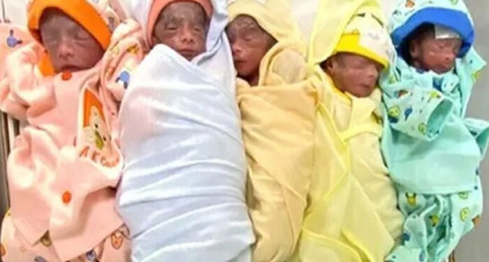 Ethiopian couple celebrates birth of five babies after 12 years